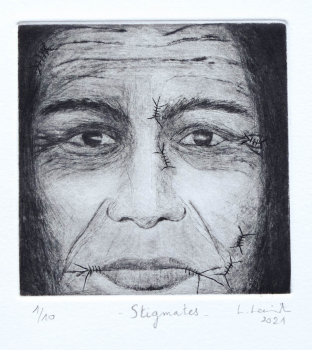 gravure-contemporaine-pointe-sèche-burin-homme-cicatrices-stigmates-linda-lewitz